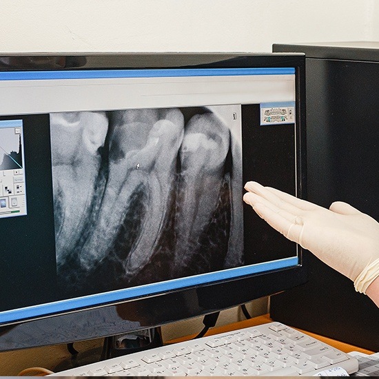 digital x-ray on desktop computer