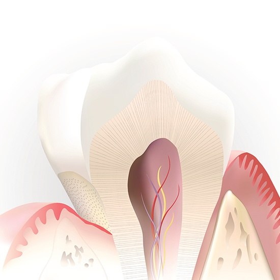Computer illustration of inside of tooth before pulp therapy