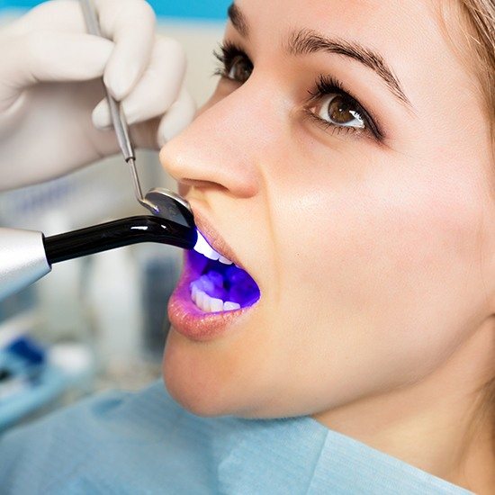 Woman getting cosmetic dental bonding treatment