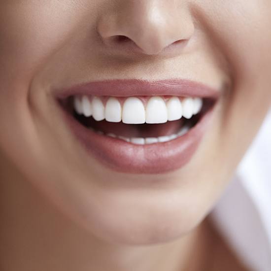 Close up of perfect smile after smile assessment and cosmetic dentistry