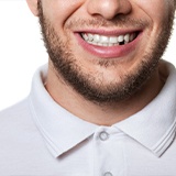 Man with missing tooth