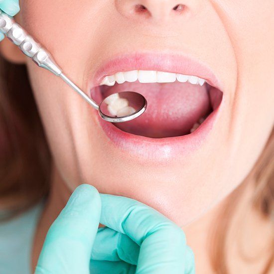 Woman having tooth colored fillings checked