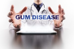 Physician holding digital gum disease.